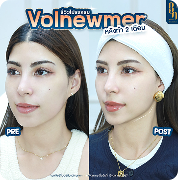 Volnewmer