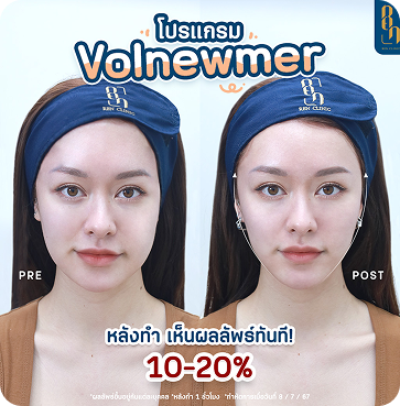 Volnewmer2