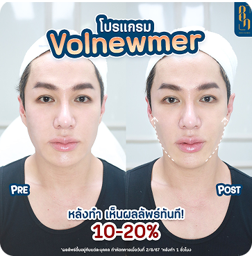 Volnewmer3