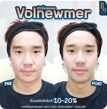 Volnewmer4