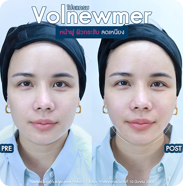 Volnewmer6
