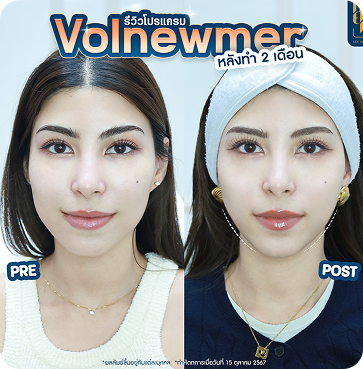 Volnewmer7