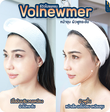 Volnewmer8