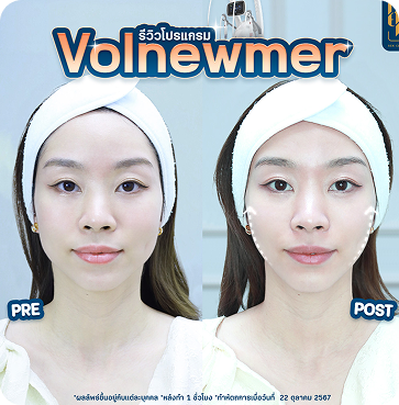 Volnewmer9